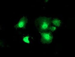DTYMK Mouse anti-Human, Clone: OTI1G8, lyophilized, TrueMAB 100 &mu;g;