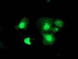 DTYMK Monoclonal Antibody (OTI1G8), TrueMAB , OriGene 100 &mu;L; Unconjugated:Antibodies,