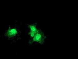 DTYMK Monoclonal Antibody (OTI1H4), TrueMAB , OriGene 30 &mu;L; Unconjugated:Antibodies,