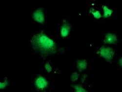 DTYMK Monoclonal Antibody (OTI1C4), TrueMAB , OriGene 100 &mu;L; Unconjugated:Antibodies,