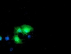 DTYMK Monoclonal Antibody (OTI2D1), TrueMAB , OriGene 100 &mu;L; Unconjugated:Antibodies,