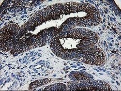 DTYMK Monoclonal Antibody (OTI1G8), TrueMAB , OriGene 100 &mu;L; Unconjugated:Antibodies,