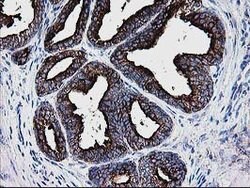 DTYMK Mouse anti-Human, Clone: OTI1G8, lyophilized, TrueMAB 100 &mu;g;