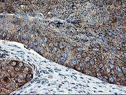 DTYMK Mouse anti-Human, Clone: OTI1G8, lyophilized, TrueMAB 100 &mu;g;
