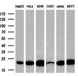 DTYMK Monoclonal Antibody (OTI1G8), TrueMAB , OriGene 100 &mu;L; Unconjugated:Antibodies,