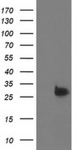 DTYMK Monoclonal Antibody (OTI1C4), TrueMAB , OriGene 100 &mu;L; Unconjugated:Antibodies,