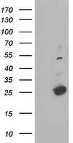 DTYMK Monoclonal Antibody (OTI1D2), TrueMAB , OriGene 100 &mu;L; Unconjugated:Antibodies,