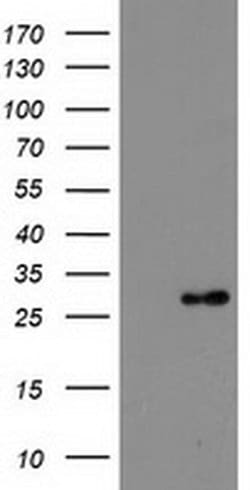 DTYMK Monoclonal Antibody (OTI2D1), TrueMAB , OriGene 100 &mu;L; Unconjugated:Antibodies,