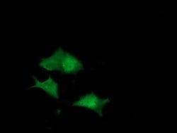 DUPD1 Monoclonal Antibody (OTI1E7), TrueMAB , OriGene 100 &mu;L; Unconjugated:Antibodies,