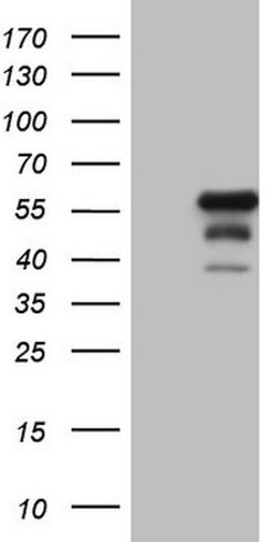 DUSP10 Mouse anti-Human, Clone: OTI1F2, lyophilized, TrueMAB 100 &mu;g;