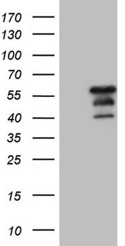 DUSP10 Monoclonal Antibody (OTI2E3), TrueMAB , OriGene 30 &mu;L; Unconjugated:Antibodies,