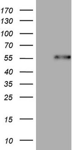 DUSP10 Mouse anti-Human, Clone: OTI2H1, lyophilized, TrueMAB 100 &mu;g;