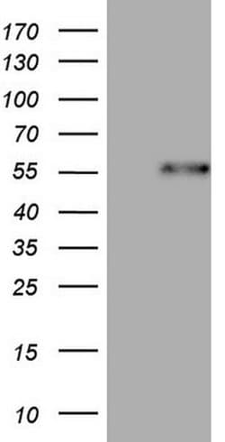 DUSP10 Mouse anti-Human, Clone: OTI2H1, liquid, TrueMAB 100 &mu;L; Unconjugated:Antibodies,