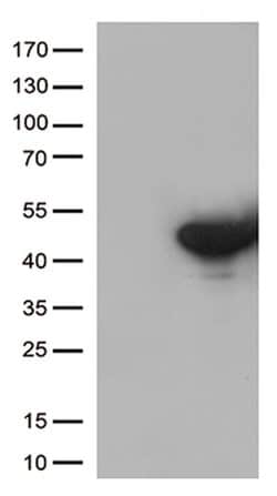 DUSP5 Mouse anti-Human, Clone: OTI2F8, lyophilized, TrueMAB 100 &mu;g;