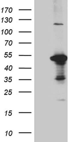 DUSP5 Monoclonal Antibody (OTI1G2), TrueMAB , OriGene 100 &mu;L | Buy Online | OriGene | Fisher Scientific