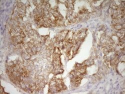 DVL2 Mouse anti-Human, Clone: OTI7C7, lyophilized, TrueMAB 100 &mu;g; Unconjugated:Antibodies,