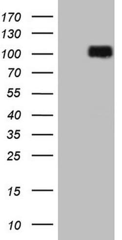 DVL2 Monoclonal Antibody (OTI1E11), TrueMAB , OriGene 100 &mu;L; Unconjugated:Antibodies,