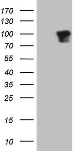 DVL2 Monoclonal Antibody (OTI1B12), TrueMAB , OriGene 100 &mu;L; Unconjugated:Antibodies,
