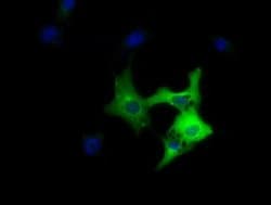 DYNC1LI1 Monoclonal Antibody (OTI1B9), TrueMAB , OriGene 100 &mu;L; Unconjugated:Antibodies,