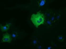 DYNC1LI1 Mouse anti-Human, Clone: OTI1C5, lyophilized, TrueMAB 100 &mu;g;