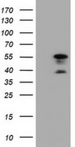 DYNC1LI1 Monoclonal Antibody (OTI1B9), TrueMAB , OriGene 100 &mu;L; Unconjugated:Antibodies,