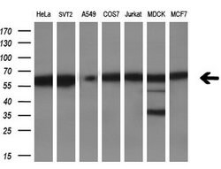 DYNC1LI1 Monoclonal Antibody (OTI1B9), TrueMAB , OriGene 100 &mu;L; Unconjugated:Antibodies,