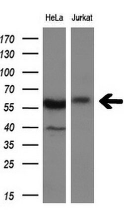 DYNC1LI1 Monoclonal Antibody (OTI2E8), TrueMAB , OriGene 100 &mu;L; Unconjugated:Antibodies,