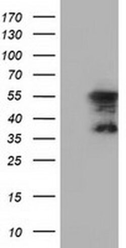 DYNC1LI1 Monoclonal Antibody (OTI2B6), TrueMAB , OriGene 30 &mu;L; Unconjugated:Antibodies,