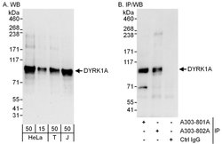 DYRK1A Rabbit anti-Human, Polyclonal, Bethyl Laboratories 100 &mu;L; Unconjugated:Antibodies,