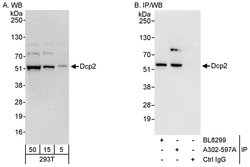 Dcp2 Rabbit anti-Human, Polyclonal, Bethyl Laboratories 100 &mu;l; Unlabeled:Antibodies,