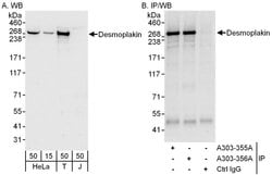 Desmoplakin Rabbit anti-Human, Polyclonal, Bethyl Laboratories 100 &mu;L;