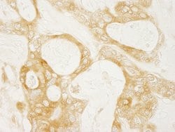 Diaphanous 1 Polyclonal Antibody, Bethyl Laboratories 100 &mu;L; Unconjugated:Antibodies,