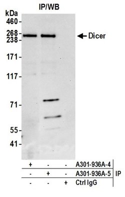 Dicer Rabbit anti-Human, Mouse, Polyclonal, Bethyl Laboratories 100 &mu;L;