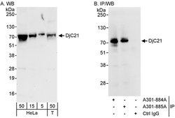 DjC21 Rabbit anti-Human, Polyclonal, Bethyl Laboratories 100 &mu;L; Unconjugated:Antibodies,