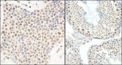 E1B-AP5 Rabbit anti-Human, Mouse, Polyclonal, Bethyl Laboratories 100 &mu;L;