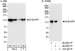 E1B-AP5 Rabbit anti-Human, Mouse, Polyclonal, Bethyl Laboratories 100 &mu;L;