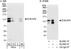 E1B-AP5 Rabbit anti-Human, Polyclonal, Bethyl Laboratories 100 &mu;L; Unconjugated:Antibodies,