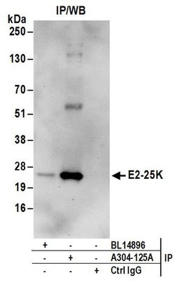 E2-25K Rabbit anti-Human, Mouse, Polyclonal, Bethyl Laboratories 100 &mu;L;