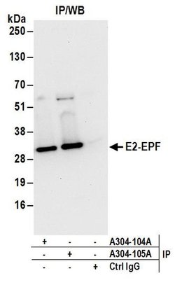 E2-EPF Rabbit anti-Human, Mouse, Polyclonal, Bethyl Laboratories 100 &mu;L | Buy Online | Bethyl Laboratories, Inc | Fisher Scientific