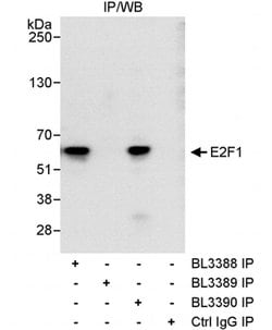 E2F1 Rabbit anti-Human, Polyclonal, Bethyl Laboratories 100 &mu;L; Unconjugated:Antibodies,