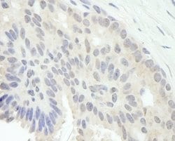 E2F1 Polyclonal Antibody, Bethyl Laboratories 10 &mu;L; Unconjugated:Antibodies,