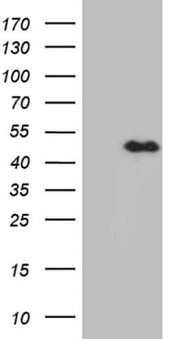 E2F5 Monoclonal Antibody (OTI3B7), TrueMAB , OriGene 100 &mu;L; Unconjugated:Antibodies,