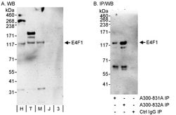 E4F1 Rabbit anti-Human, Polyclonal, Bethyl Laboratories 100 &mu;L; Unconjugated:Antibodies,