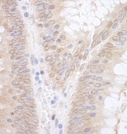 EAF2 Rabbit anti-Human, Polyclonal, Bethyl Laboratories 100 &mu;L; Unconjugated:Antibodies,