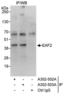 EAF2 Rabbit anti-Human, Polyclonal, Bethyl Laboratories 100 &mu;L; Unconjugated:Antibodies,