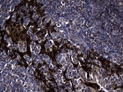EARS2 Mouse anti-Human, Clone: OTI2C1, lyophilized, TrueMAB 100 &mu;g;