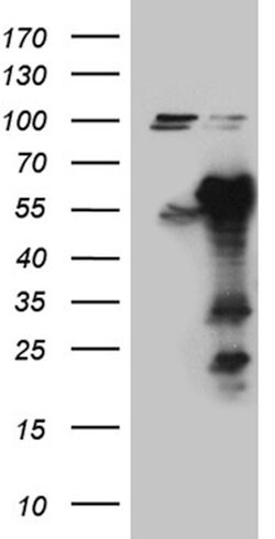 EARS2 Mouse anti-Human, Clone: OTI2C1, lyophilized, TrueMAB 100 &mu;g;