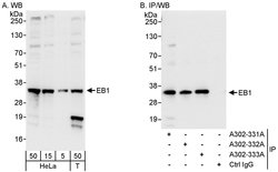 EB1 Rabbit anti-Human, Polyclonal, Bethyl Laboratories 100 &mu;L; Unconjugated:Antibodies,