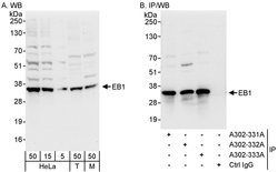 EB1 Rabbit anti-Human, Mouse, Polyclonal, Bethyl Laboratories 100 &mu;L;