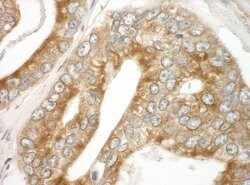 EB1 Polyclonal Antibody, Bethyl Laboratories:Antibodies:Primary Antibodies